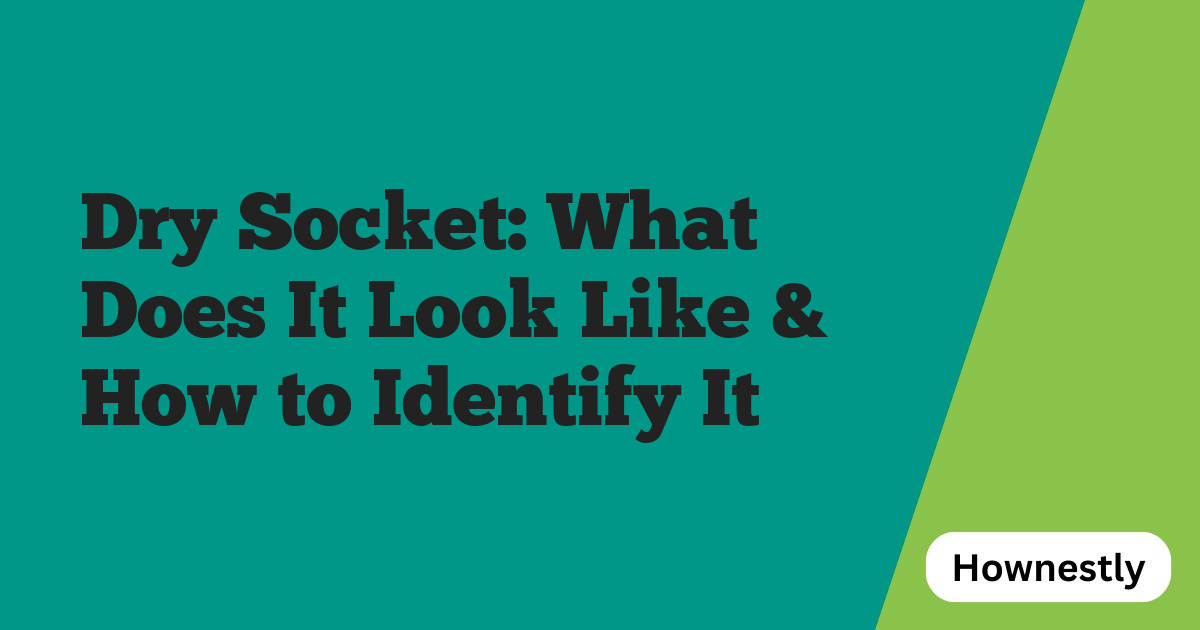 Dry Socket: What Does It Look Like & How to Identify It