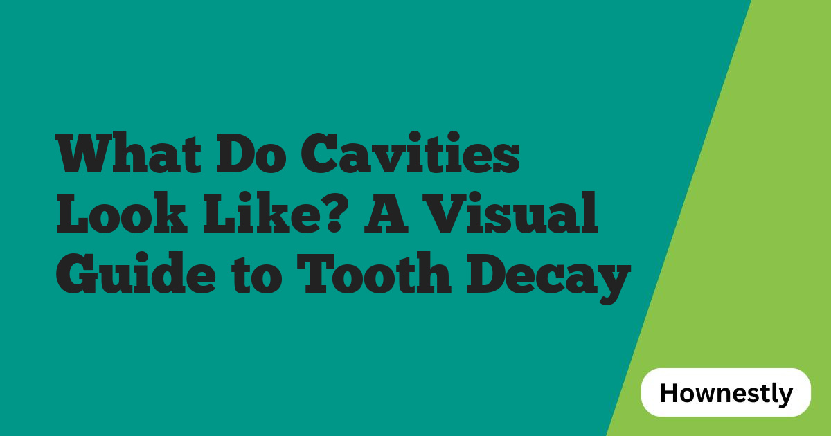 What Do Cavities Look Like? A Visual Guide to Tooth Decay