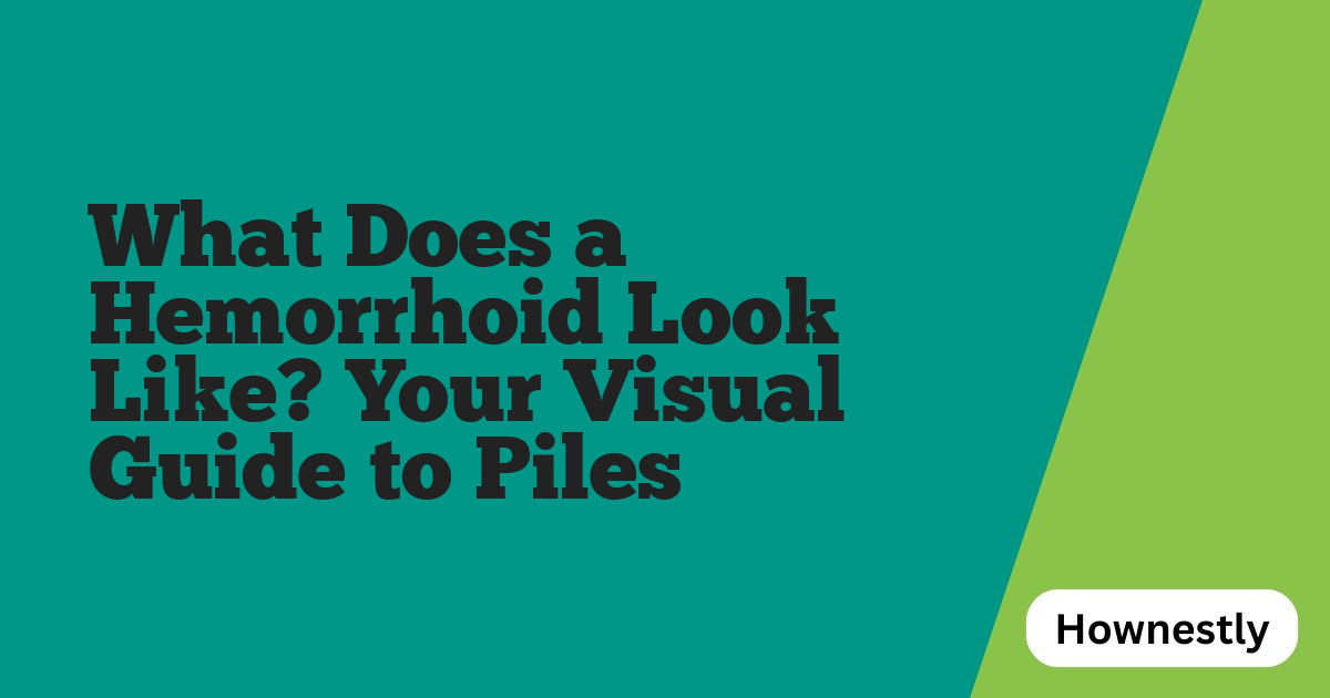 What Does a Hemorrhoid Look Like? Your Visual Guide to Piles