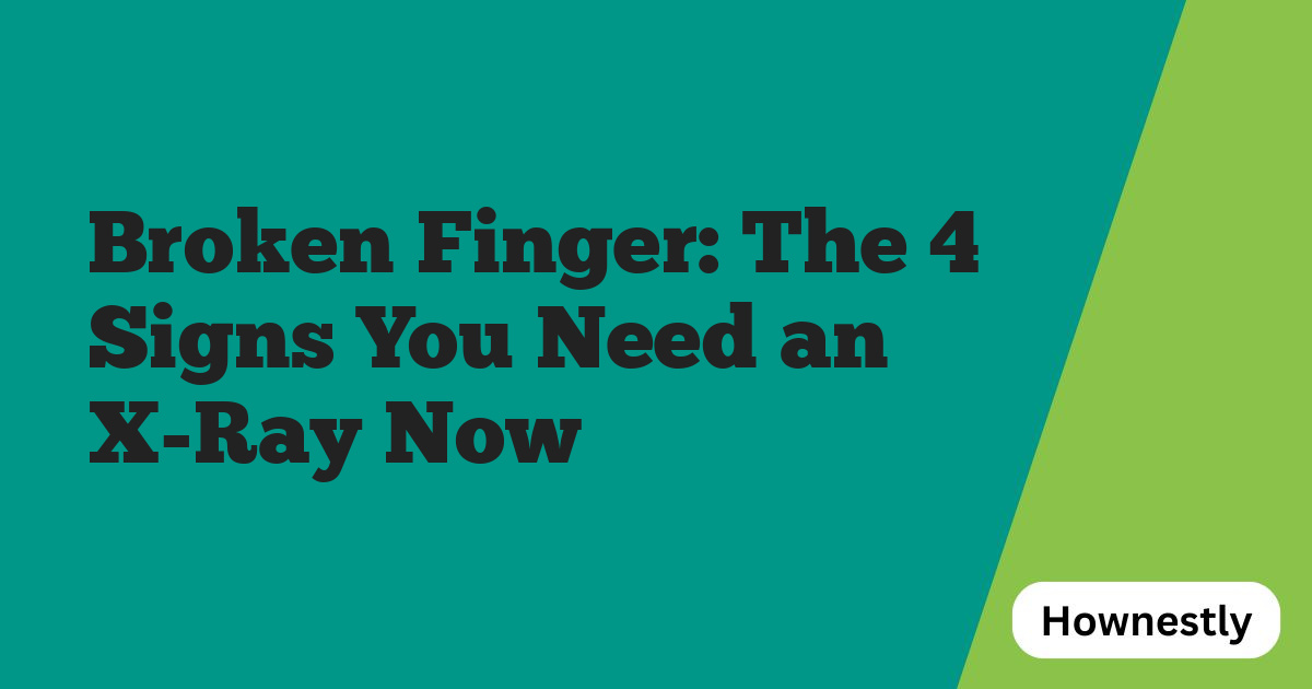Broken Finger: The 4 Signs You Need an X-Ray Now