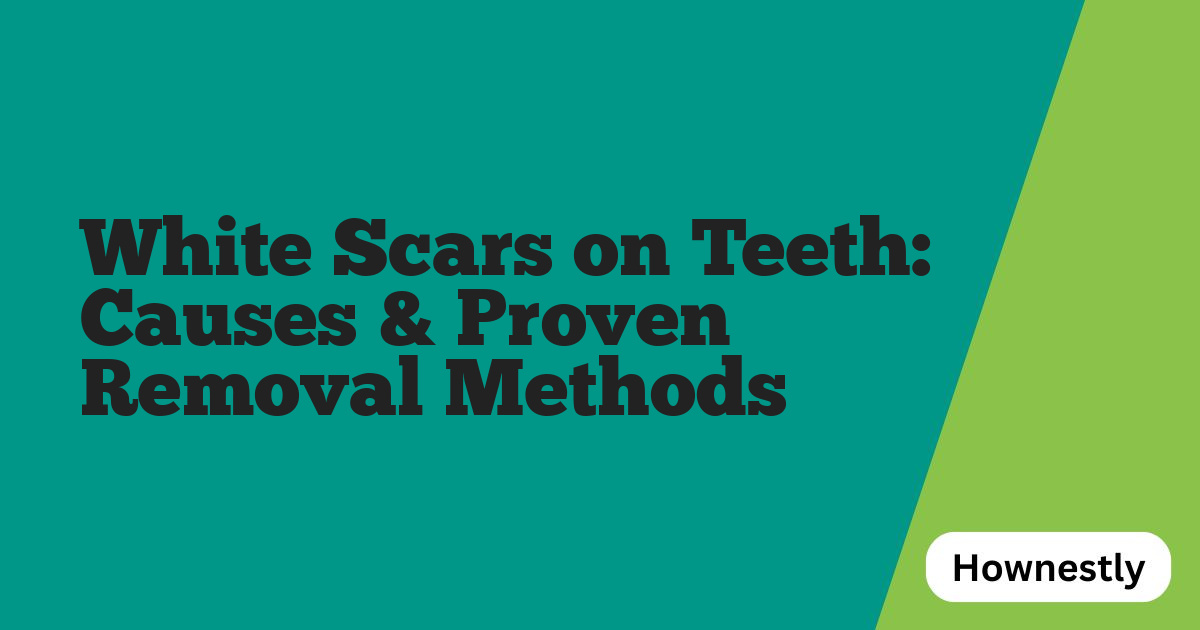 White Scars on Teeth: Causes & Proven Removal Methods